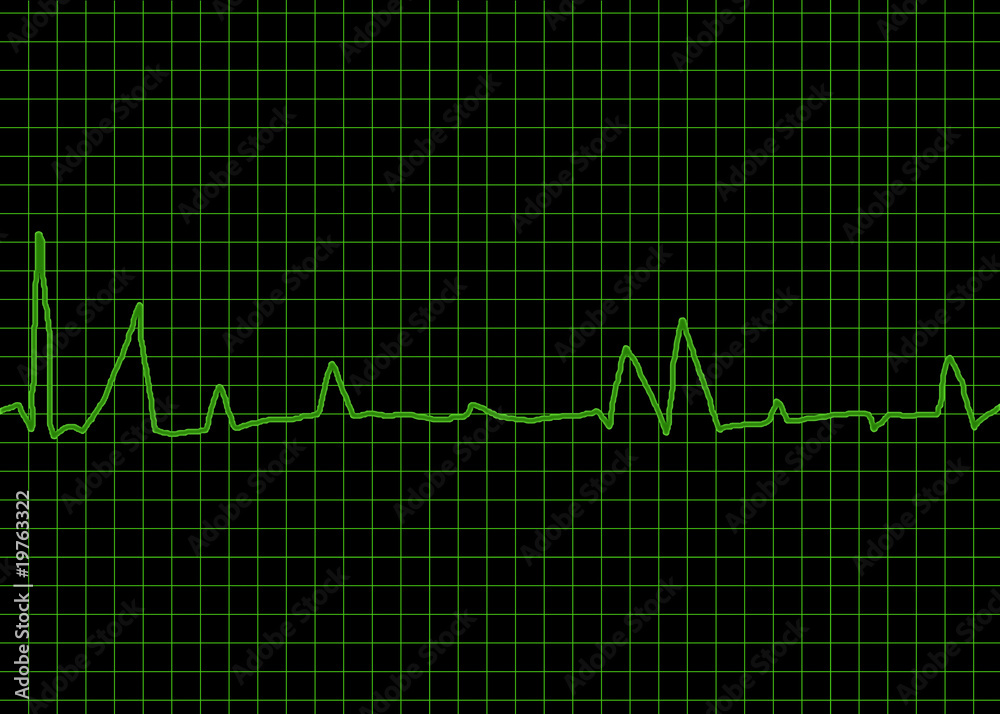 Naklejka premium EKG