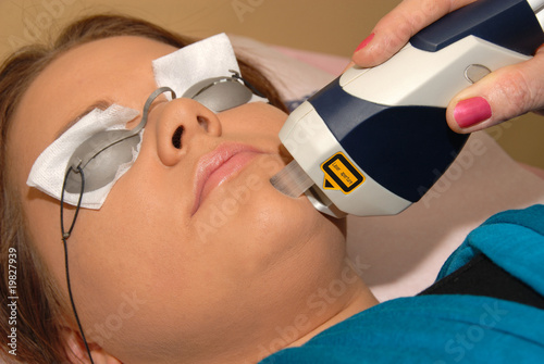 Skincare laser pigment color change at day spa