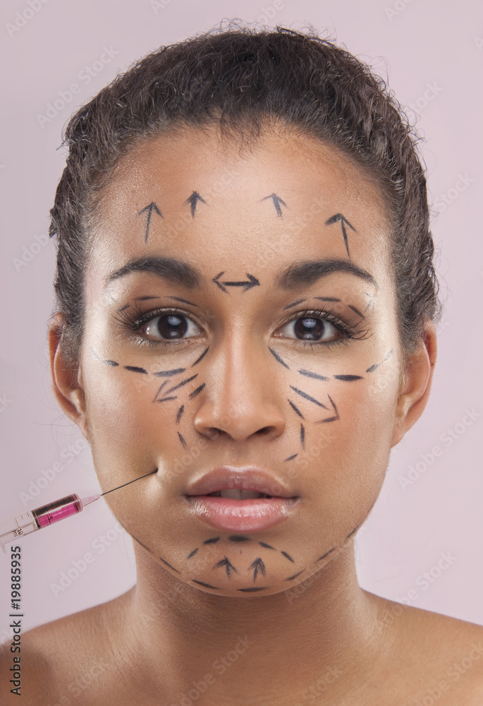 botox botox