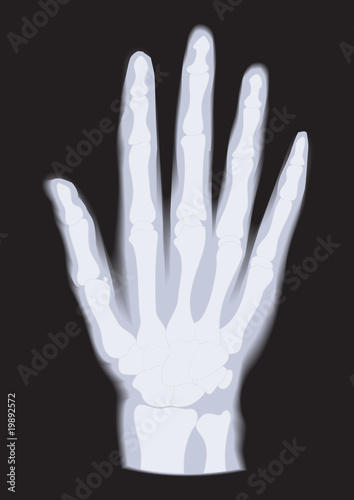 Hand x-ray