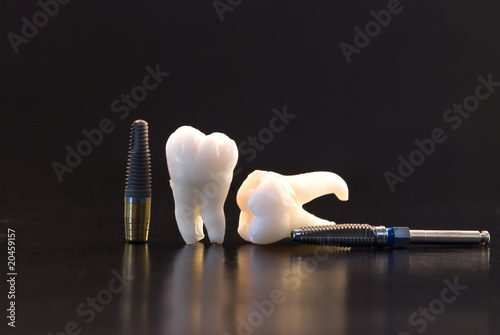 Dental Implants and teeth