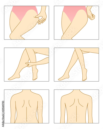 エステ　ダイエット　痩せる