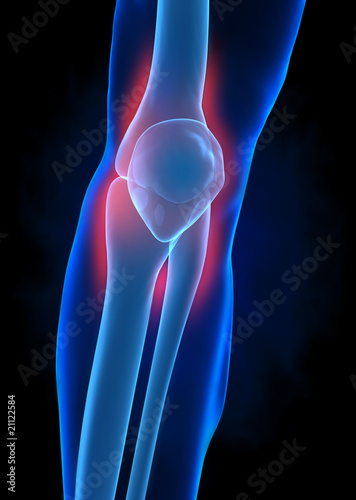 Injured knee concept