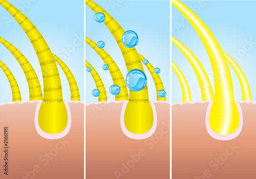 Illustration of three phase of hair cure, vector