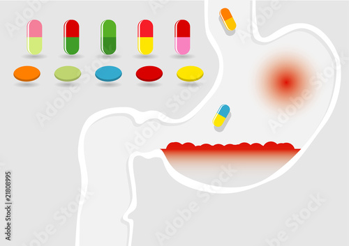 Illustration of medical pills