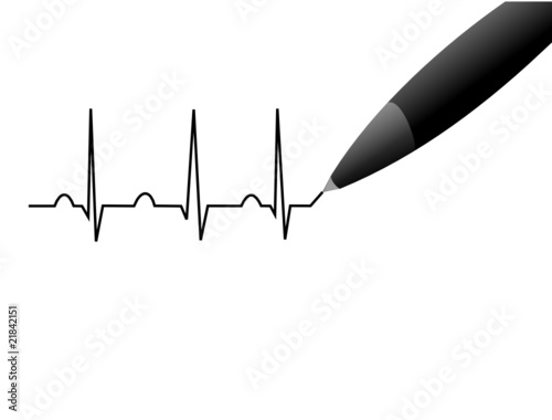 Electrocardiogramme