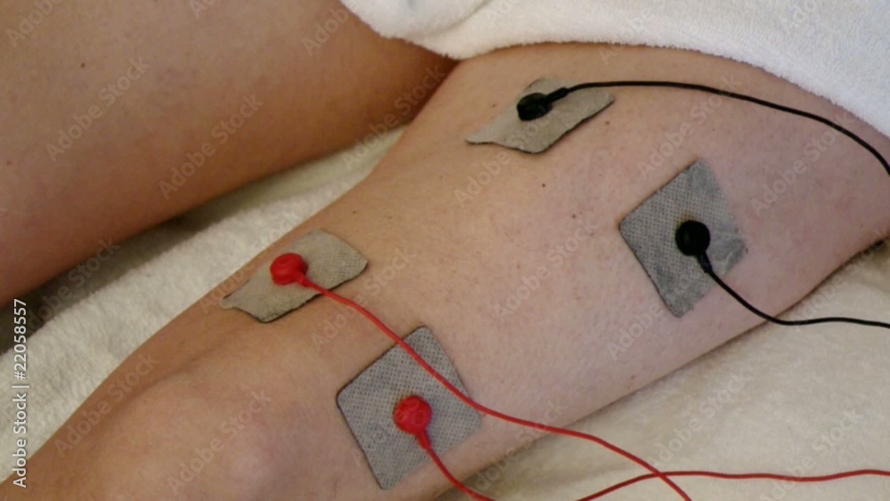 Elettrostimolazione 01 04 10