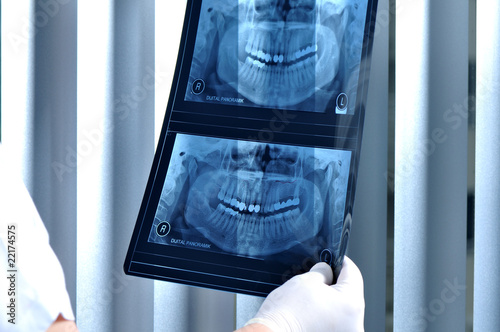 Dentist looking at x ray of patients teeth