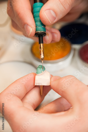 Making of a Tooth Crown