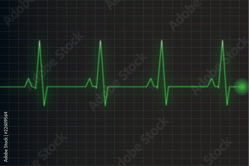 Illustration of electrical activity of the human heart