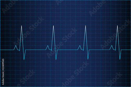 Illustration of electrical activity of the human heart
