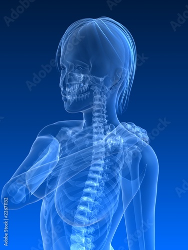 weibliches Skelett mit schmerzender Schulter