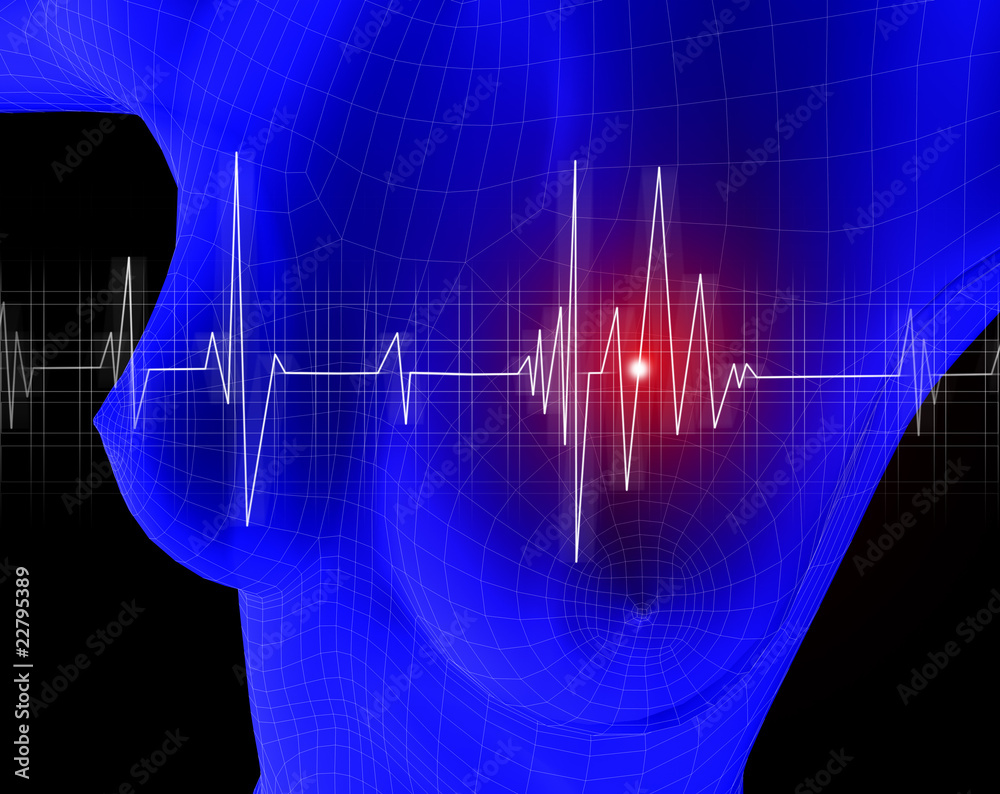 cardiograma cardiograma