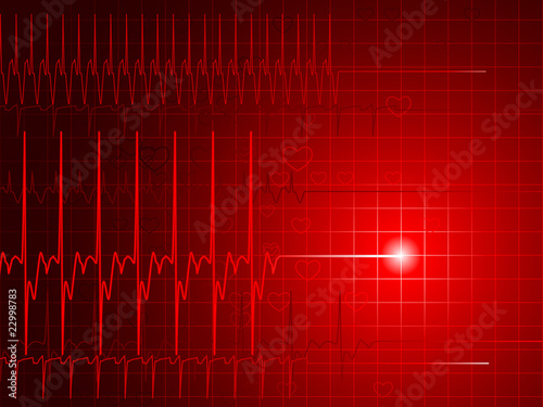 Flatline monitor photo