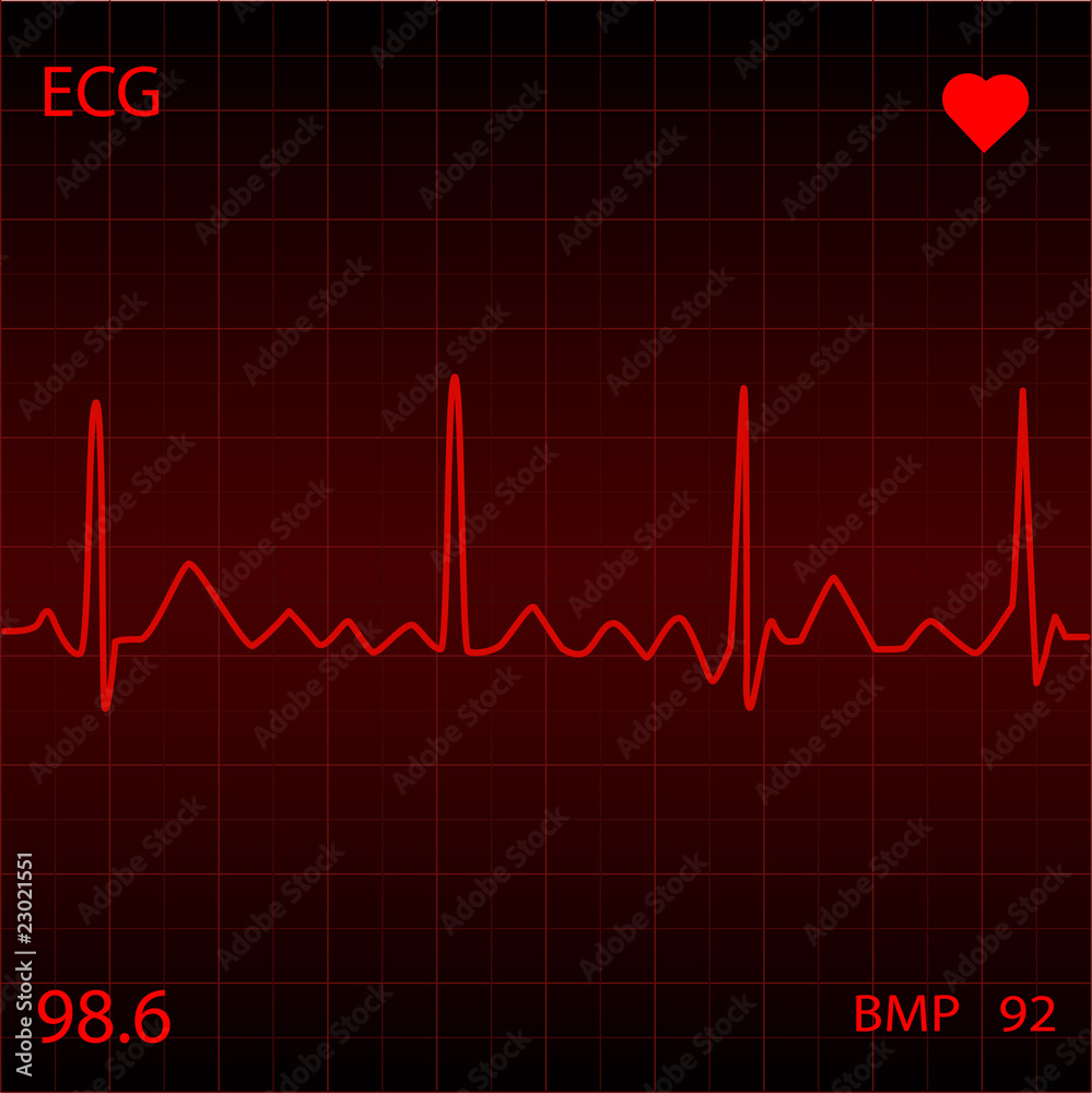 Red Heart Monitor Red Heart Monitor