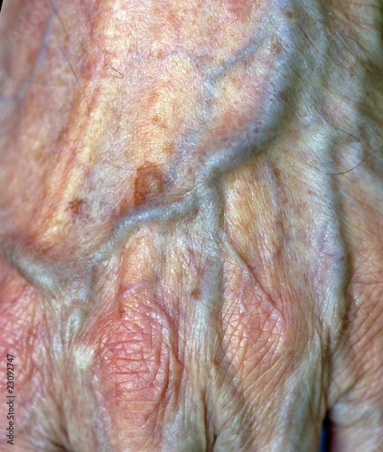 artery