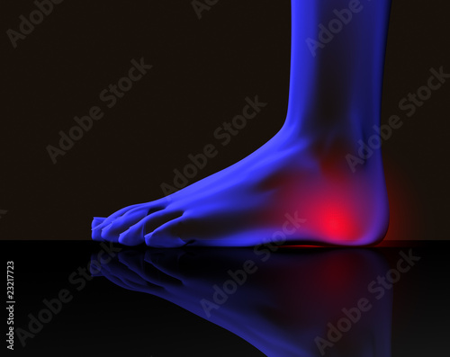 dolor en pie
