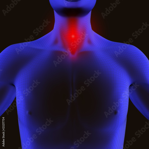 dolor en garganta 2