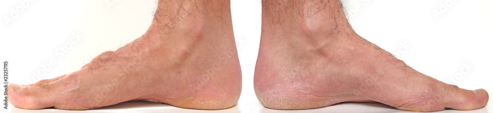 Fototapeta premium Internal Feet and ankle