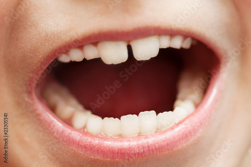 Teeth macro