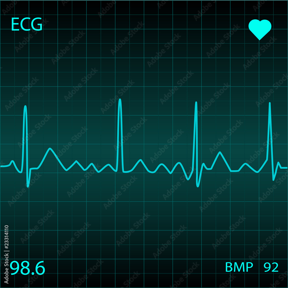 Blue Heart Monitor Blue Heart Monitor