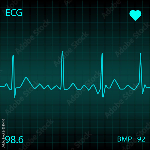 Blue Heart Monitor