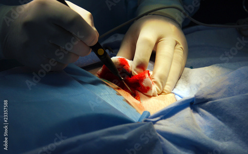 Surgery. Cancer ill women operation