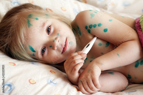 Obraz na plátně Girl suffers chickenpox