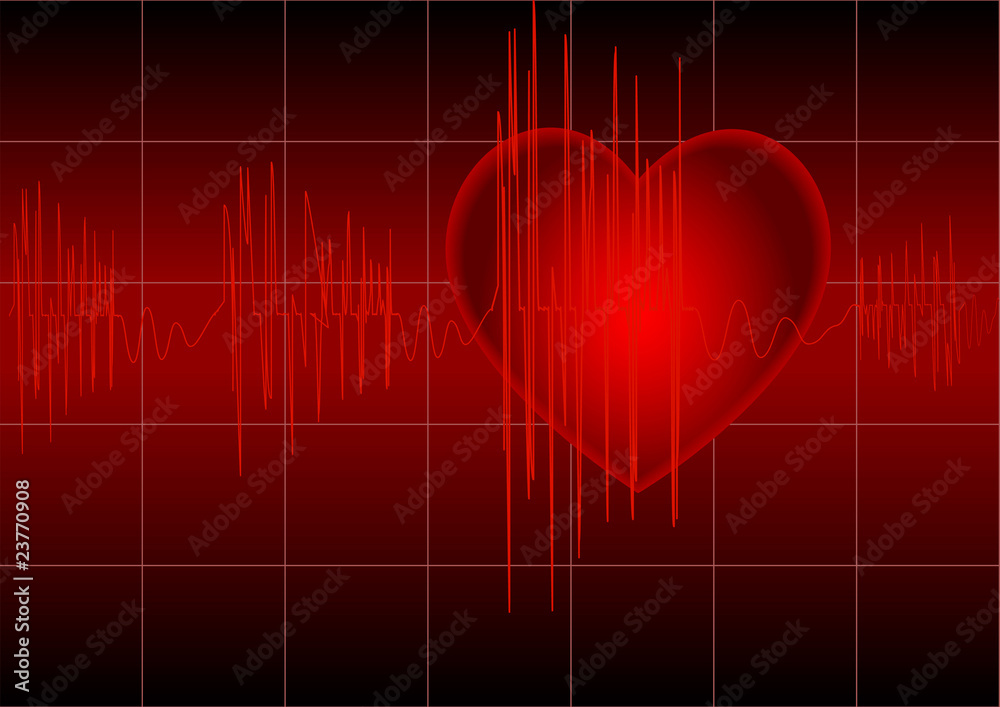 The cardiogram