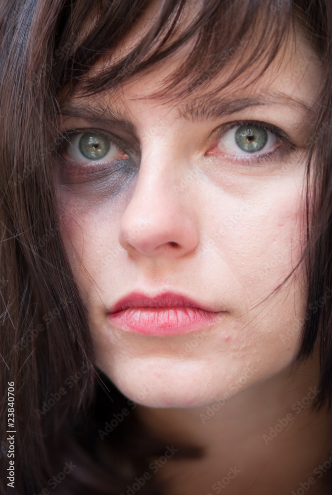 Closeup of Young Attractive woman with a black eye Closeup of Young Attractive woman with a black eye