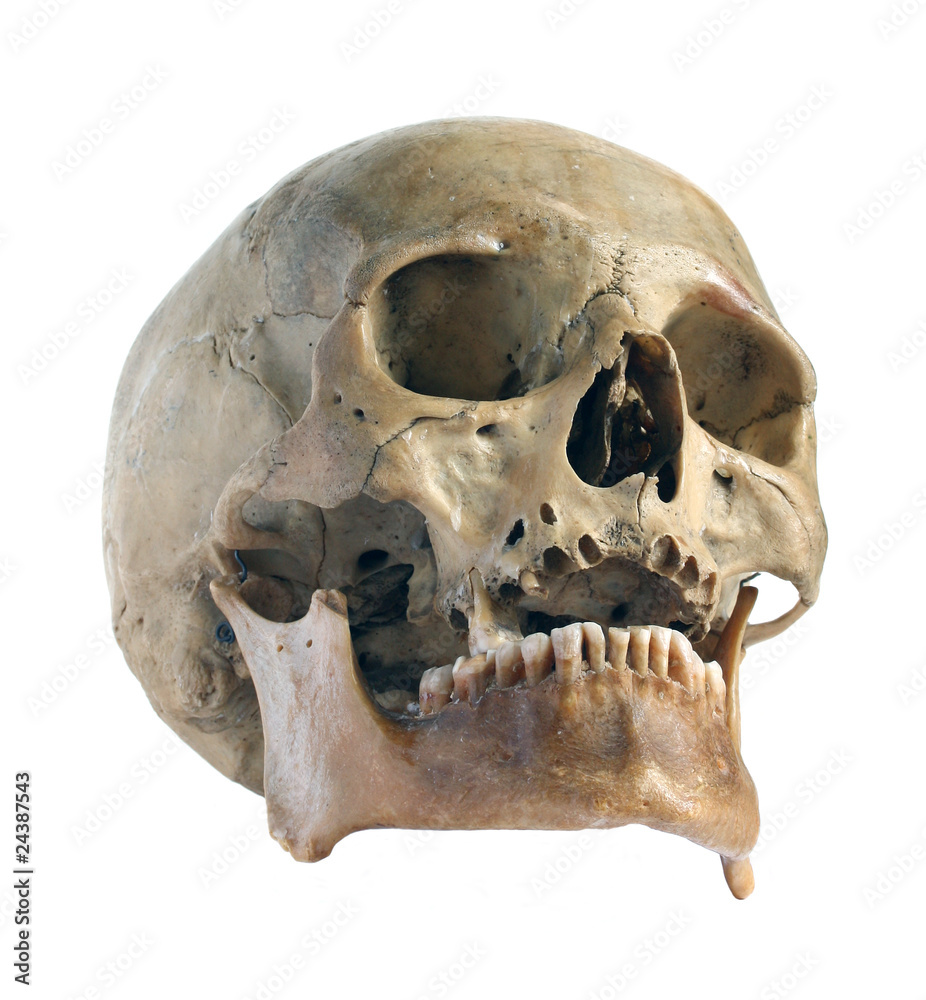 Skull of the person close-up. Skull of the person close-up.