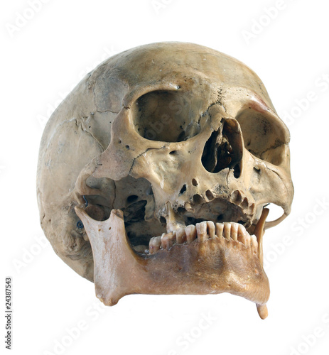 Skull of the person close-up.