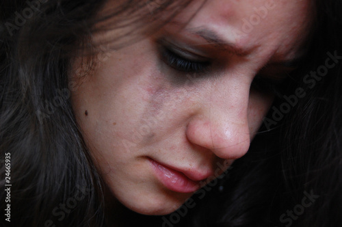Hurt