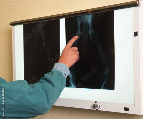 radiographie de la hanche d'un chien - dysplasie