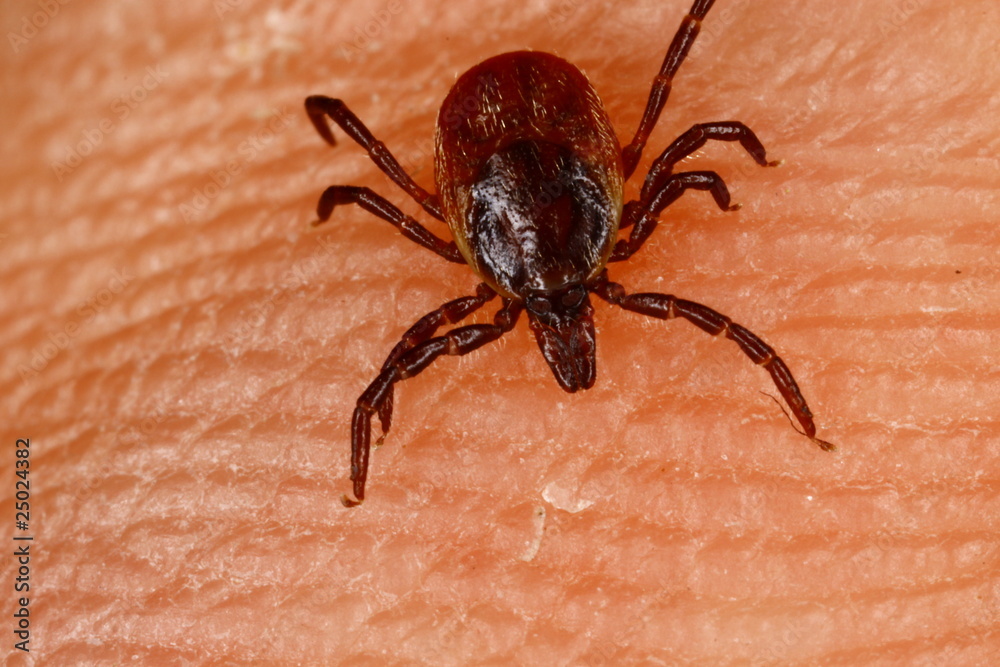 Ixodes ricinus tick on human skin Ixodes ricinus tick on human skin