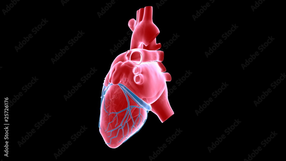 heart xray