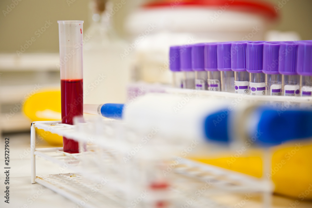 blood sample and a pipette in the lab blood sample and a pipette in the lab
