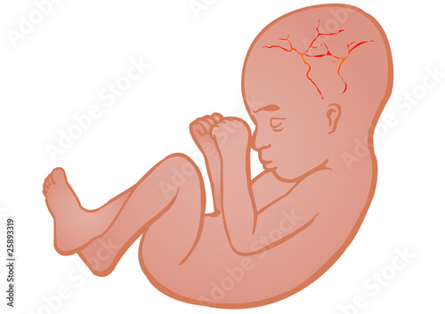 Vector illustration germ in a womb of mother