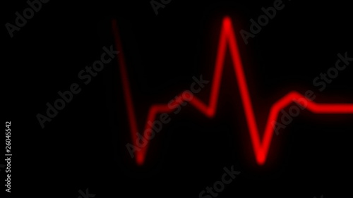 heart beat on ekg