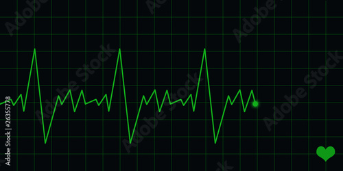 ECG Electrocardiogram