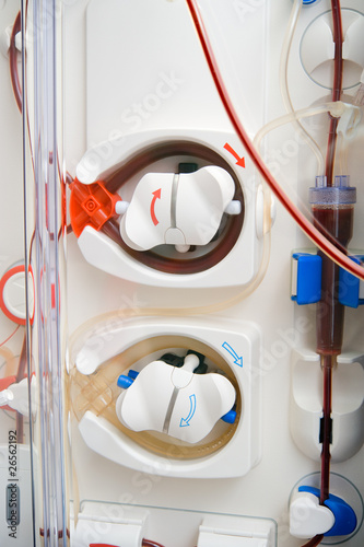 Close-up dialysis filter of a hemodialysis machine photo