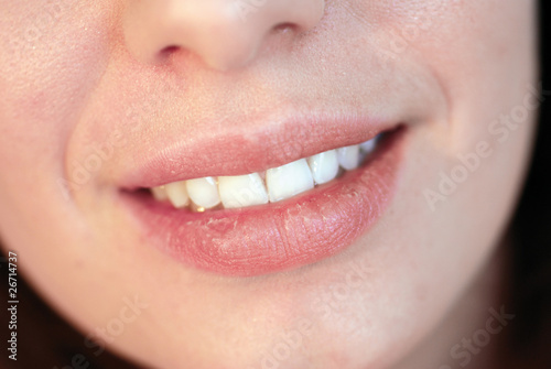 Shot of beautiful young girl with dry lips smiling