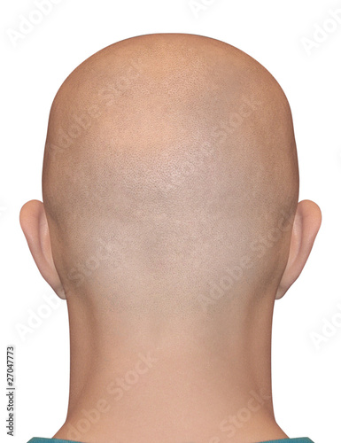 Bald head man. Smooth shaved nape isolated on white background. Alopecia illustration