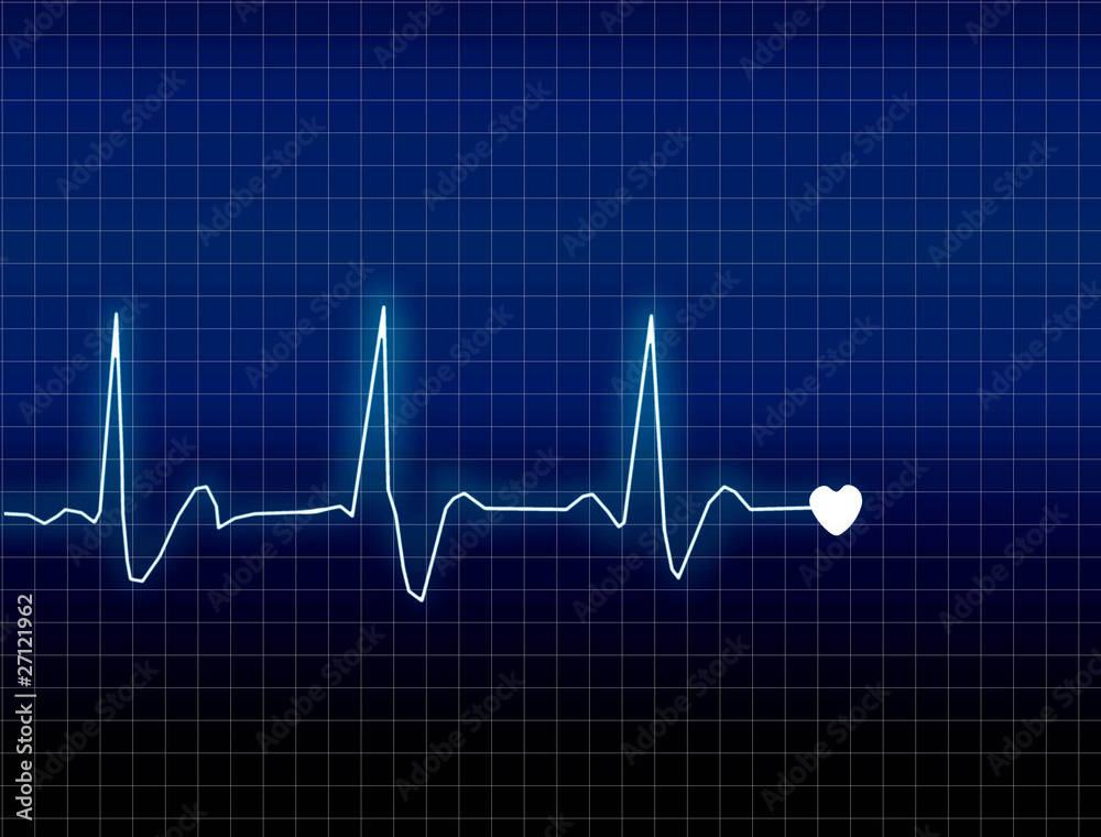 ECG ECG