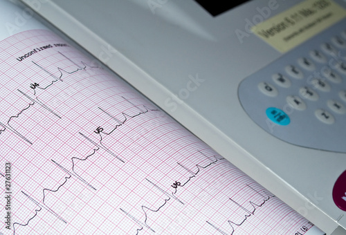 Electrocardiogram.