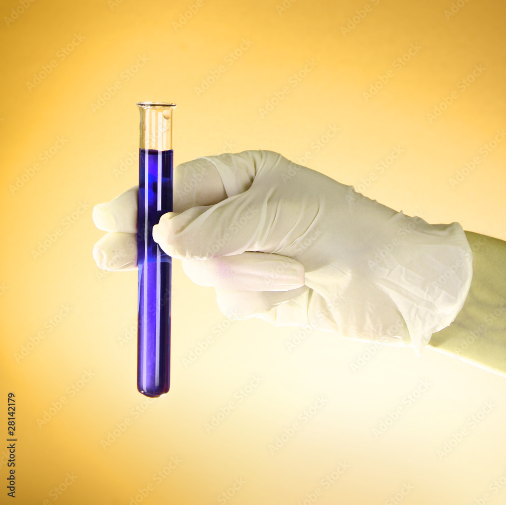 Test tube with liquid in the doctor's hand on the yellow backgro Test tube with liquid in the doctor's hand on the yellow backgro
