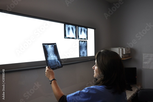 Scanner - Radio - Imagerie médicale