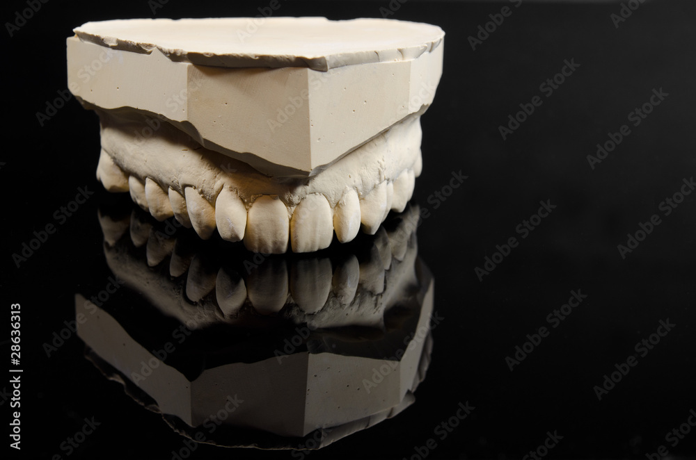 plaster cast of upper human jaw
