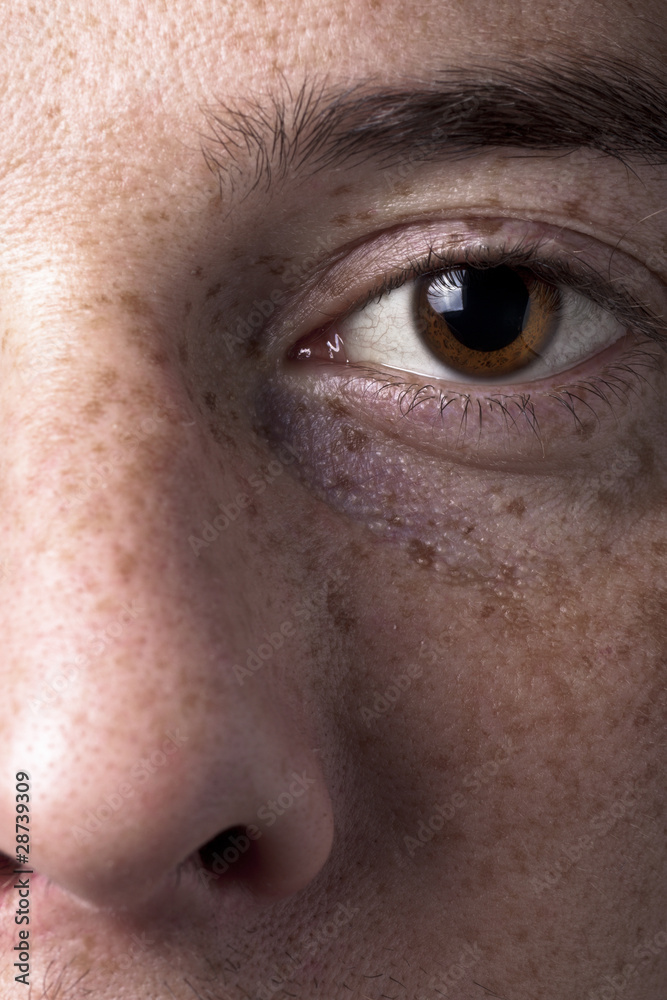 Fototapeta premium Oko i piegi