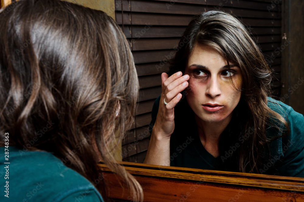 Fototapeta premium Extent of injuries; domestic abuse concept